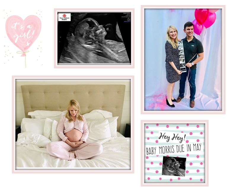 baby girl, baby girl announcement, pink, sonogram